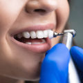 The Importance of Regular Dental Cleanings