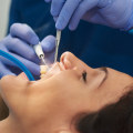 The Ins and Outs of Dental Work: What You Need to Know