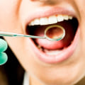 The Importance of Basic Dental Care