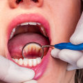 The Importance of Regular Dental Cleanings and Deep Cleanings