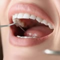 4 Steps to Achieving a Healthy Smile