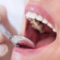 The Importance of Oral Hygiene: A Dentist's Perspective