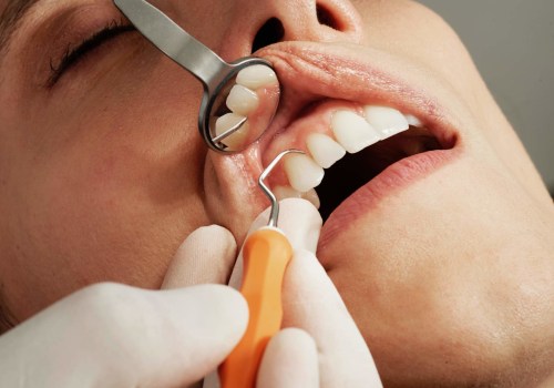 The Importance of Regular and Deep Dental Cleaning