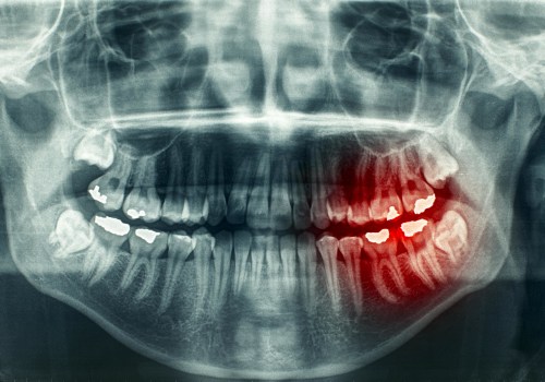 Understanding the Medical Terminology for Dental Health