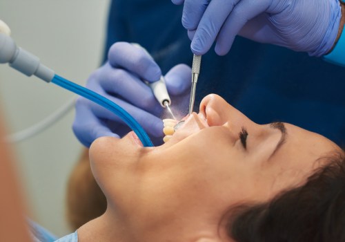 The Ins and Outs of Dental Work: What You Need to Know