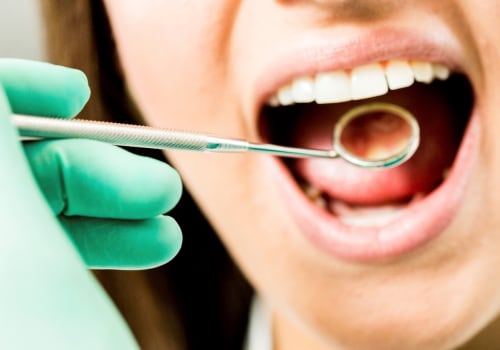 The Importance of Basic Dental Care