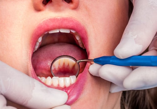 The Importance of Regular Dental Cleanings and Deep Cleanings