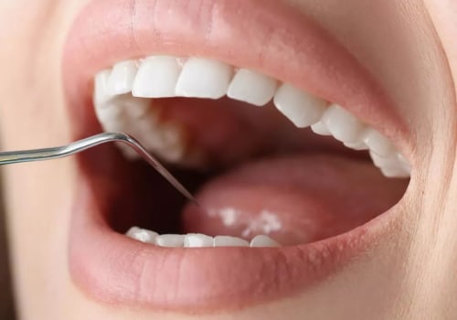 4 Steps to Achieving a Healthy Smile