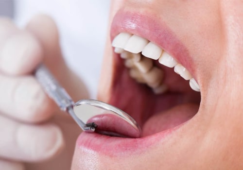 The Importance of Oral Hygiene: A Dentist's Perspective